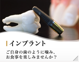 インプラント